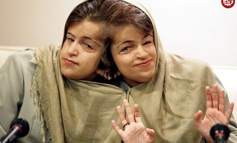 تاریخ و سفر در زمان؛ (عکس) تیپ زمستانی «عارف» دهه 50 لاله و لادن کودکی (عکس) سفر در زمان؛ تیپ زمستانی «عارف» در دهه 50؛ لاله و لادن در کودکی