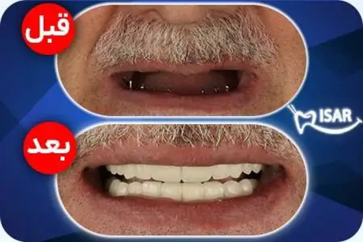 294207881760889854 چرا تخت جمشید مهم است