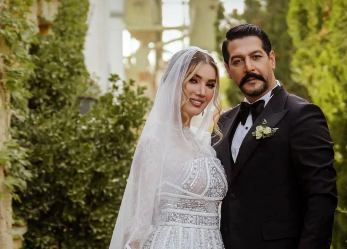 چهره روز | عکس پربازدیدِ متین ستوده قبل از عمل‌های زیبایی